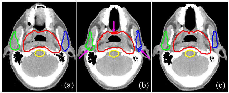 Fig. 2