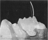 250