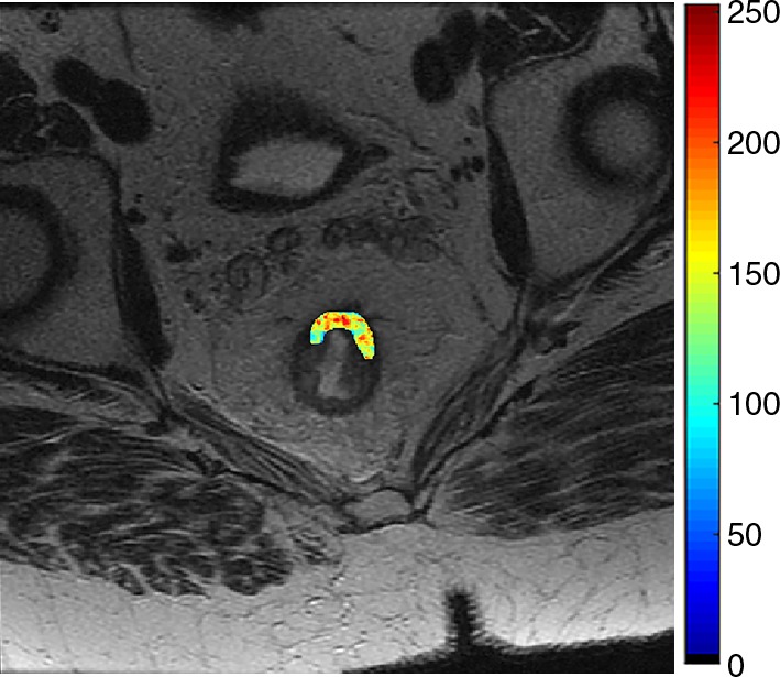 Figure 4d: