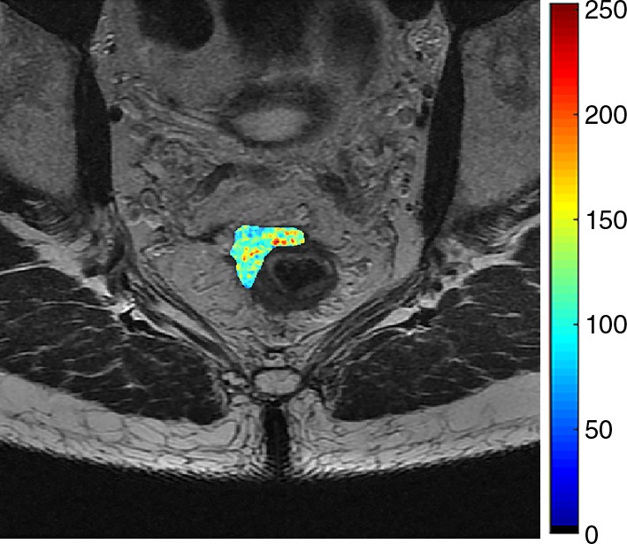 Figure 5d: