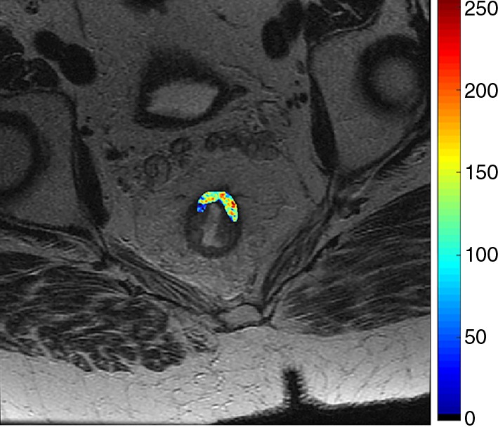 Figure 4b: