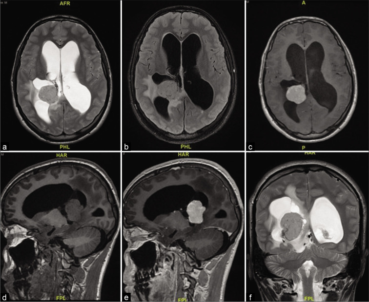 Figure 3: