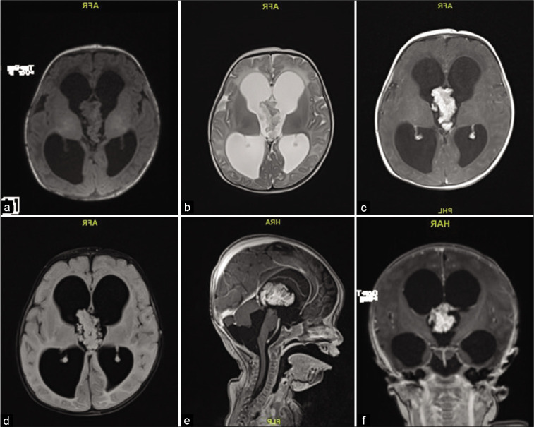 Figure 1: