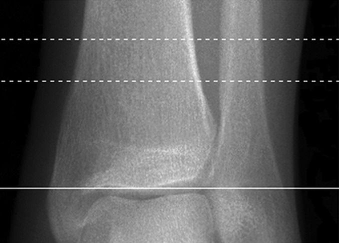 Fig. 1-C