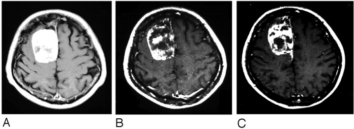 Fig 3.