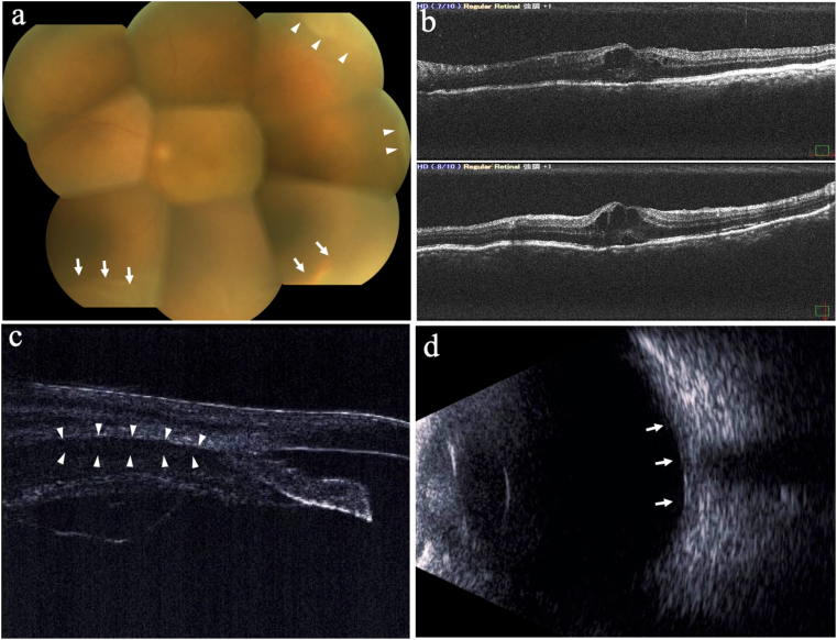 Fig. 2