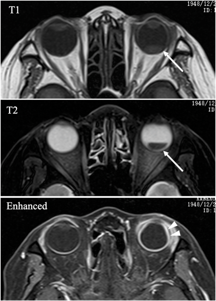 Fig. 4