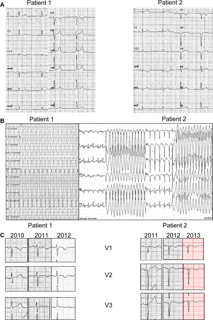 Figure 1