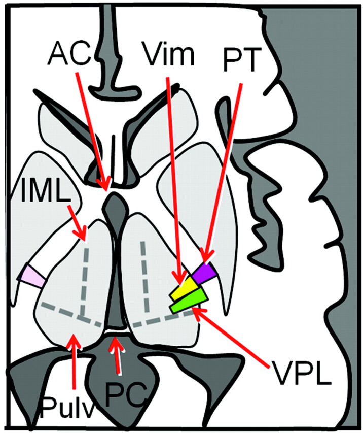 Fig 3.