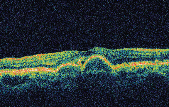 Fig. 6