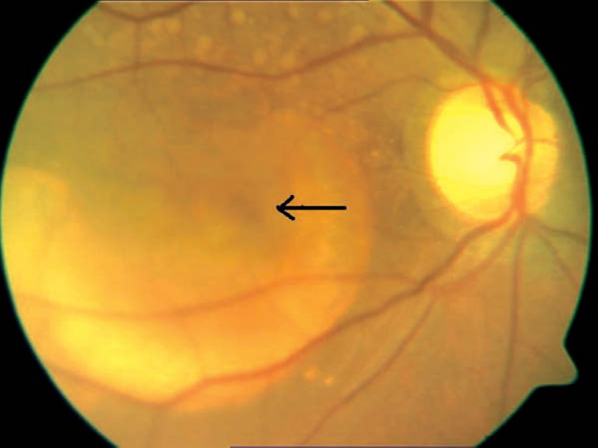 Fig. 1