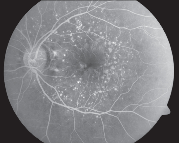 Fig. 4