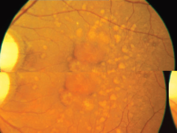 Fig. 2