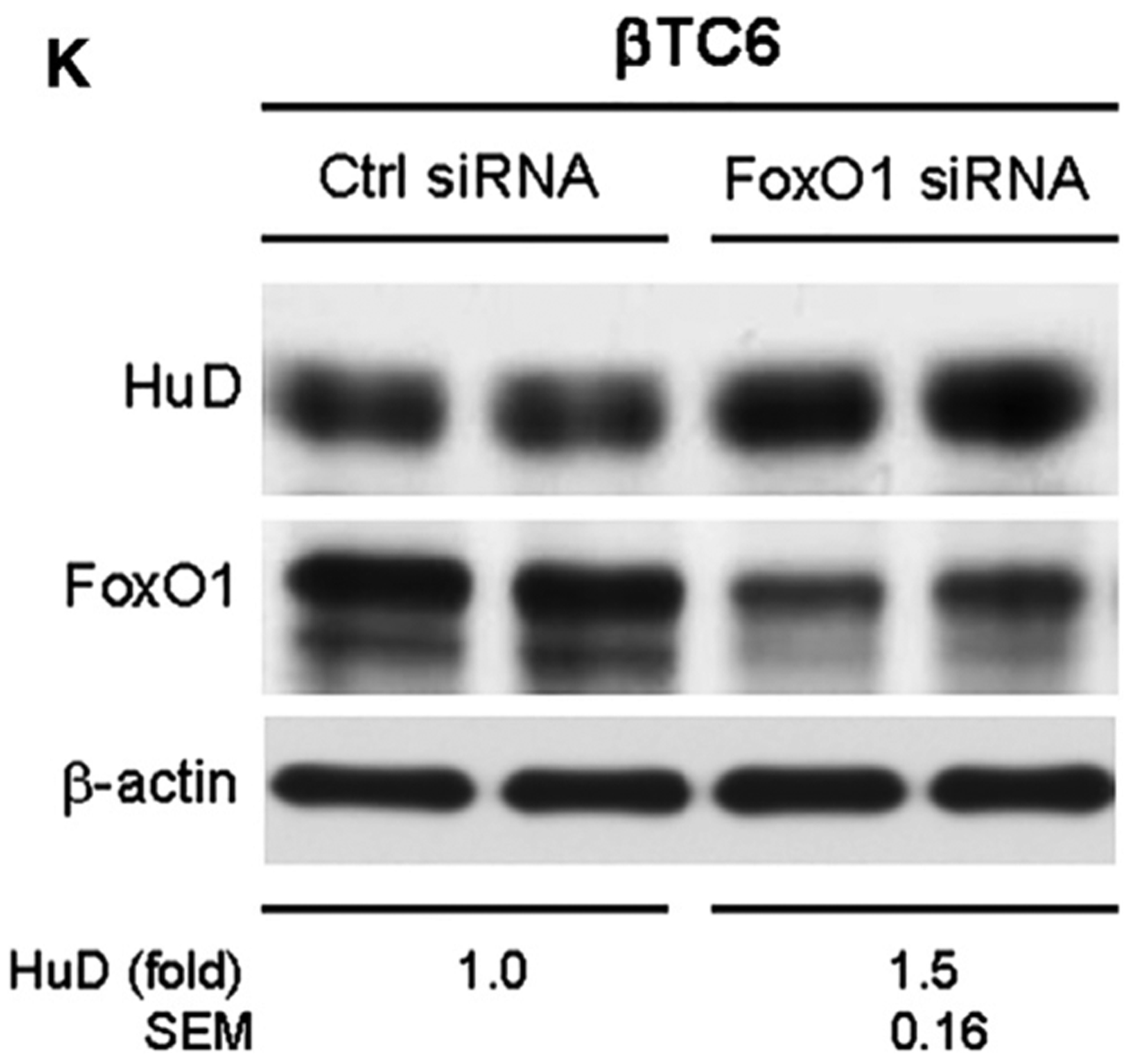 Figure 1K.