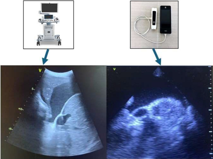 Fig. 2