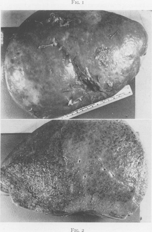 Fig. 1., Fig. 2.