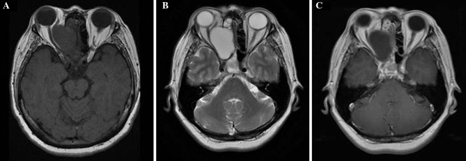 Fig. 2