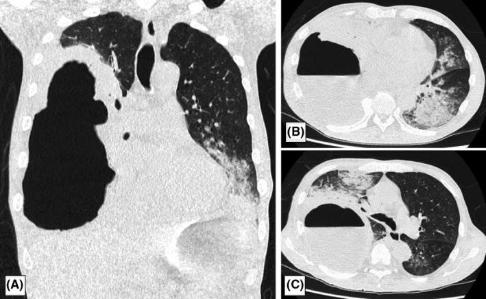 Fig. 1