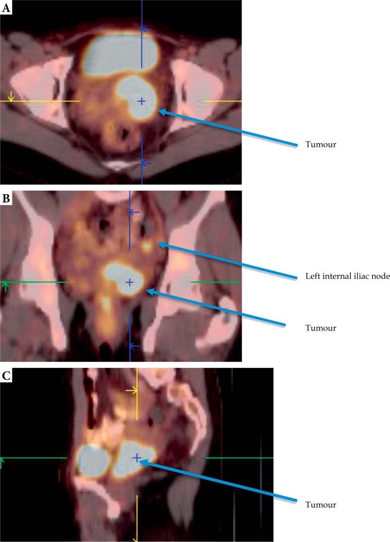 Fig. 2