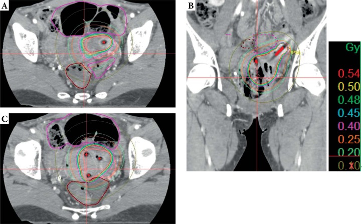 Fig. 4