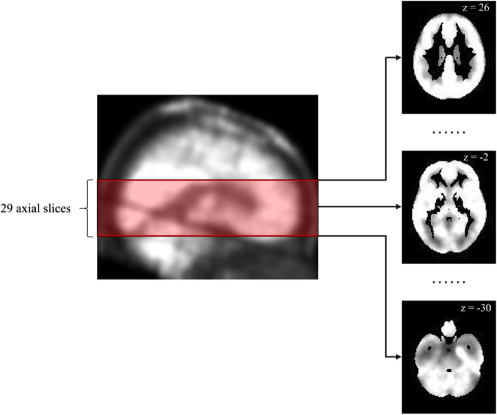 Fig. 1