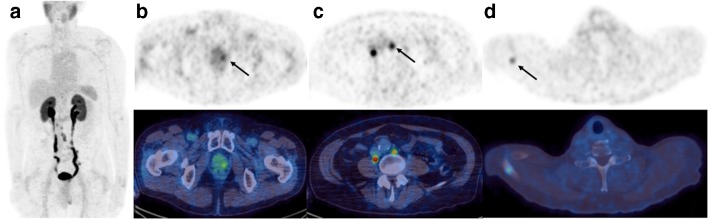 Fig. 1