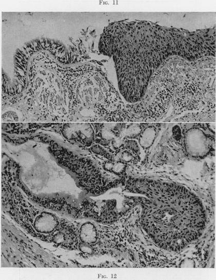 Fig. 11., Fig. 12.