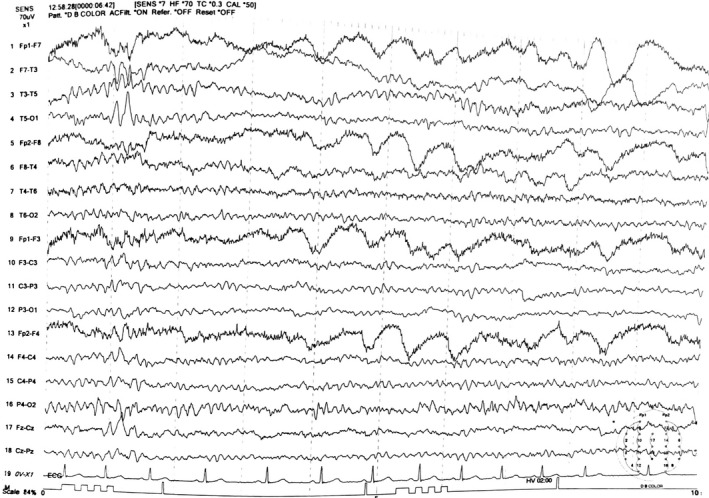 FIGURE 1