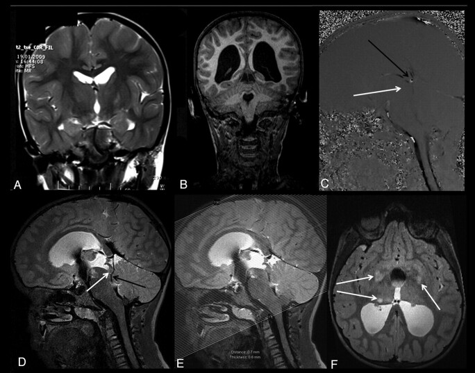 Fig 4.