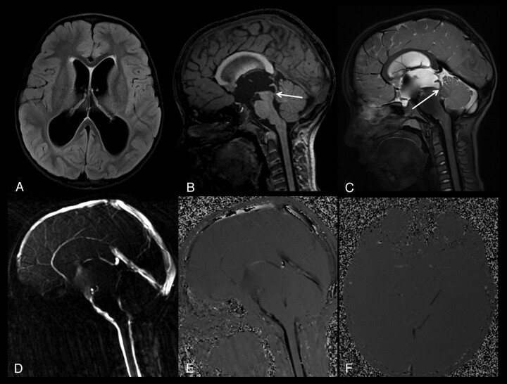 Fig 3.