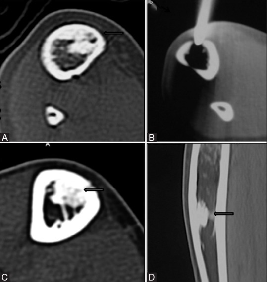 Figure 4(A-D)