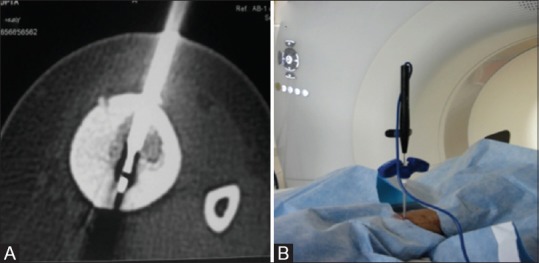 Figure 3(A and B)