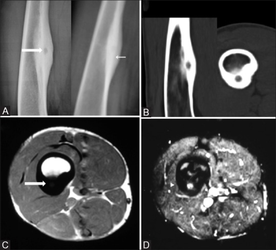 Figure 1(A-D)