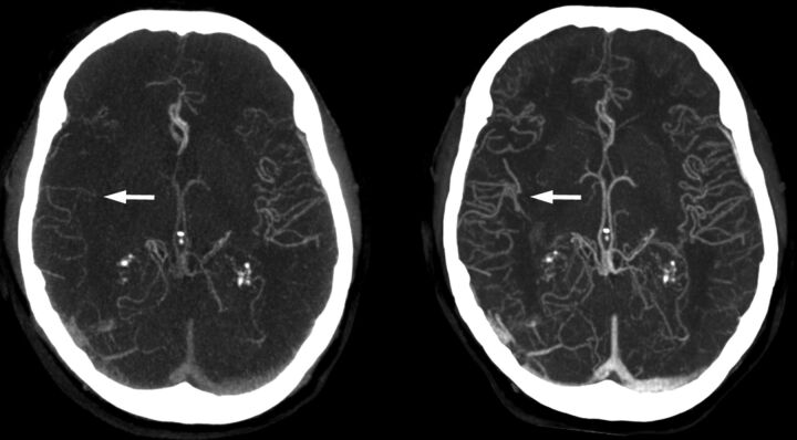 Fig 3.