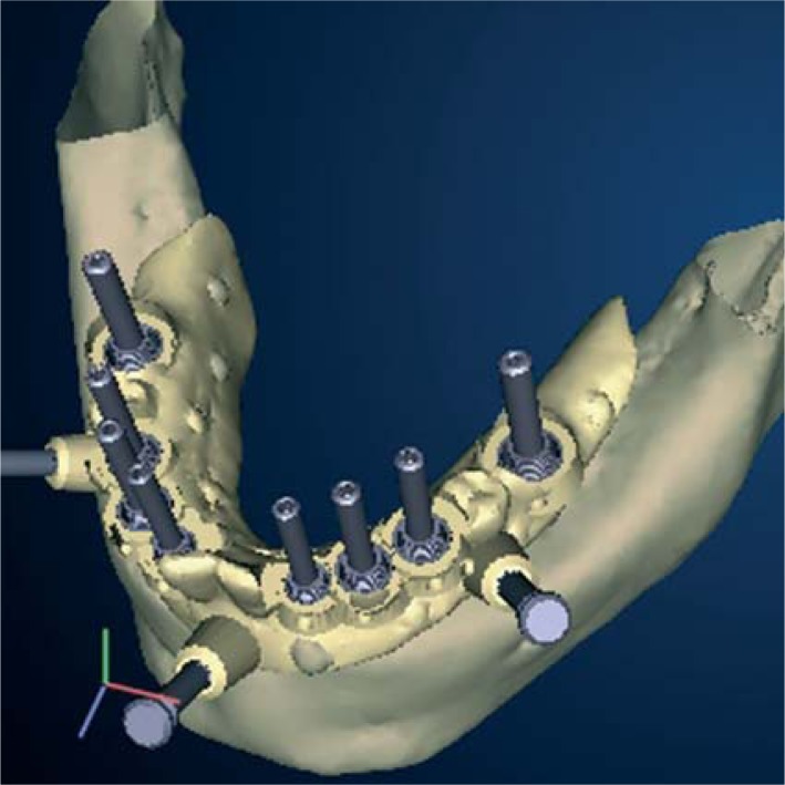 Figure 4