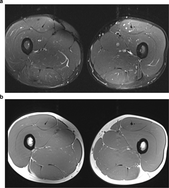 Figure 11.