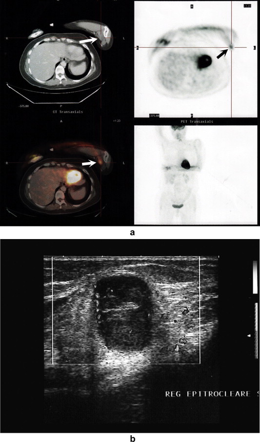 Fig. 4