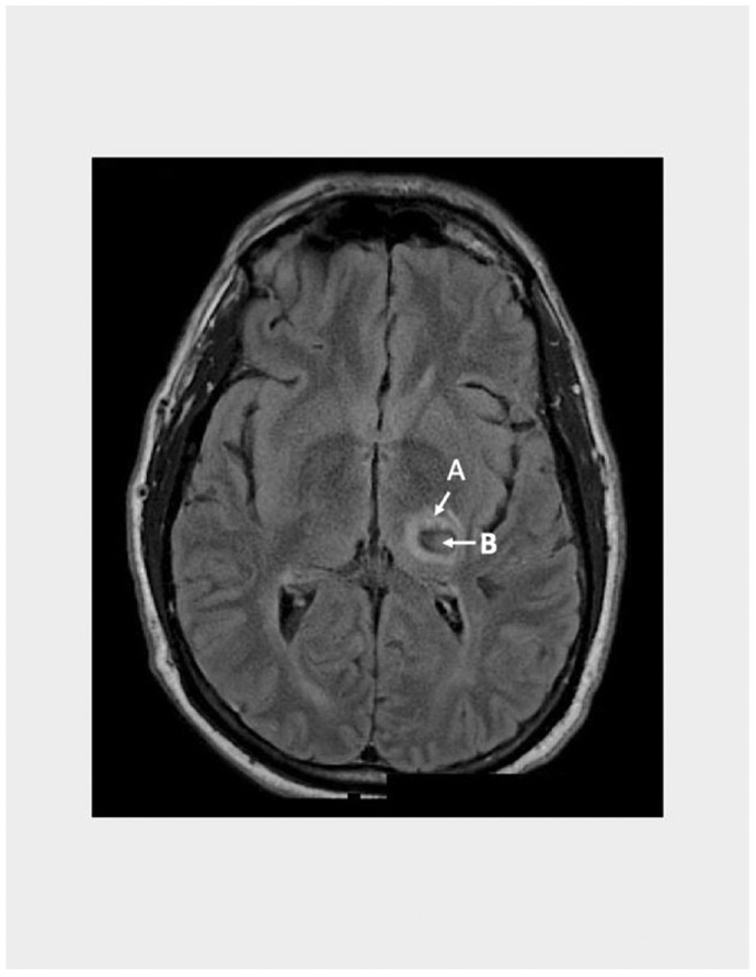 FIGURE 2: