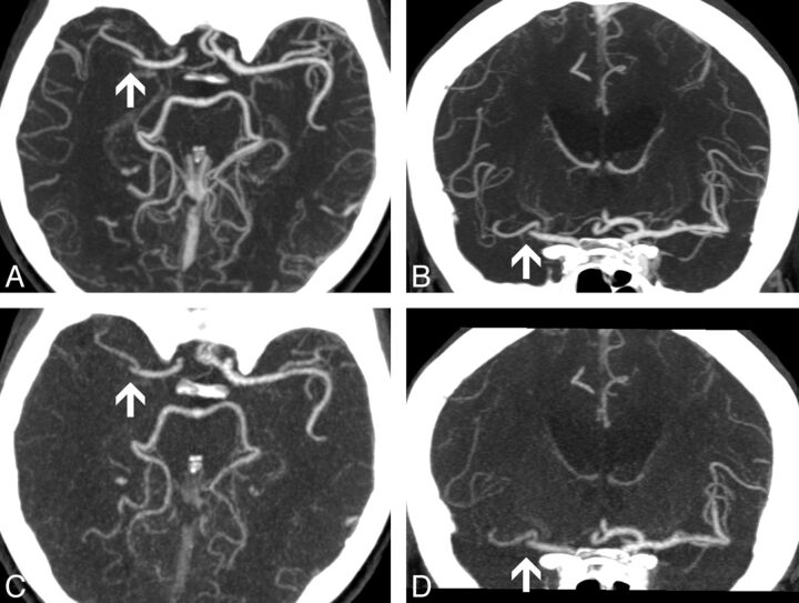 Fig 1.