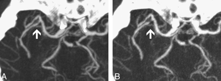 Fig 4.