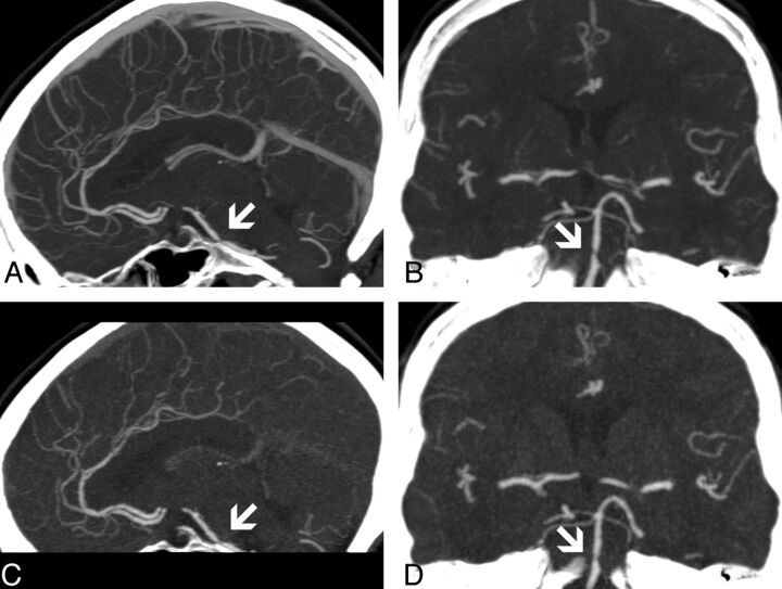 Fig 3.