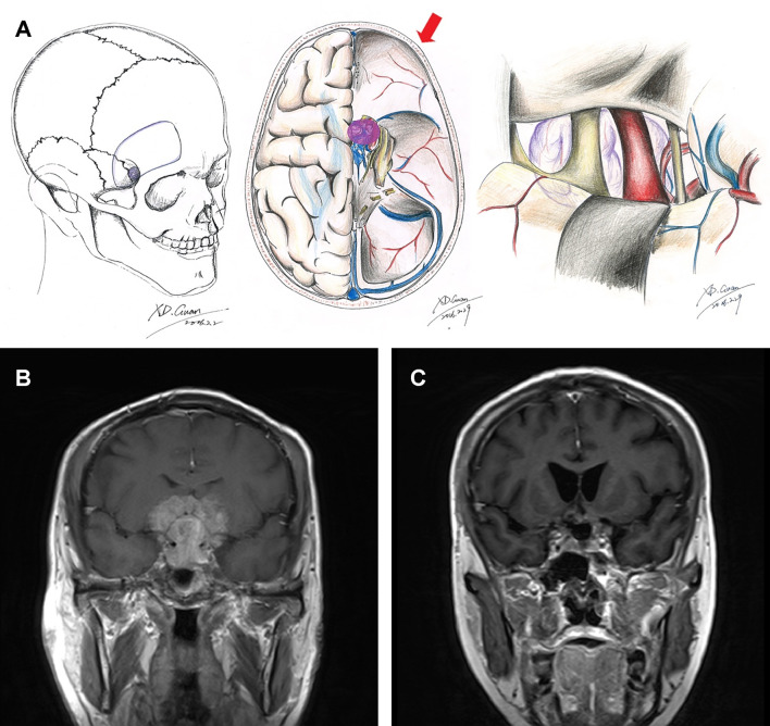 Figure 1