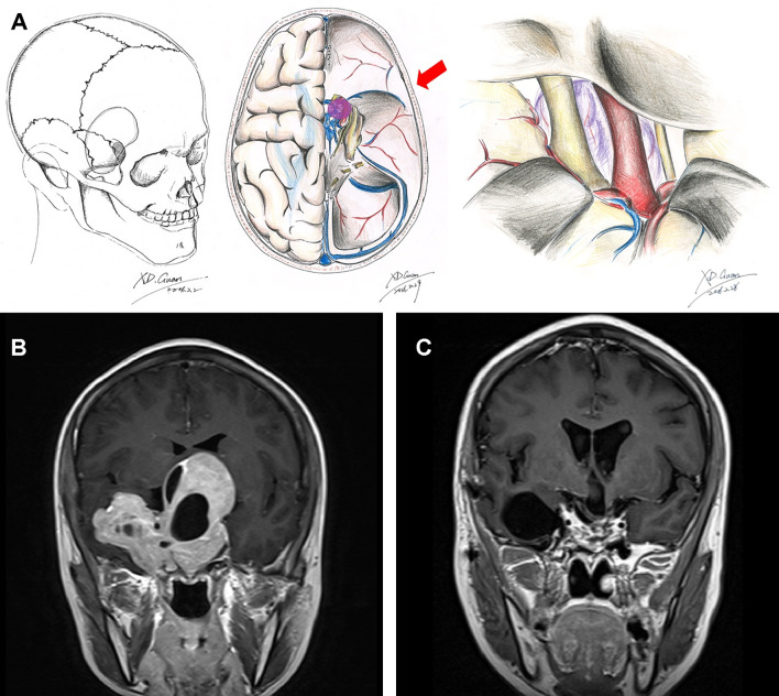 Figure 2