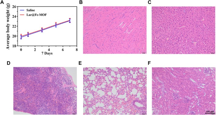 FIGURE 11