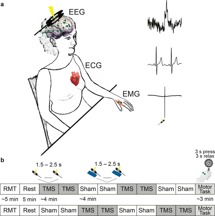 Fig 1