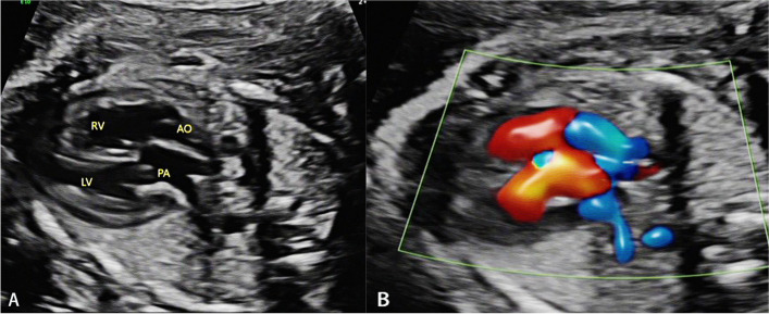 Fig. 1