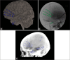 Figure 2: