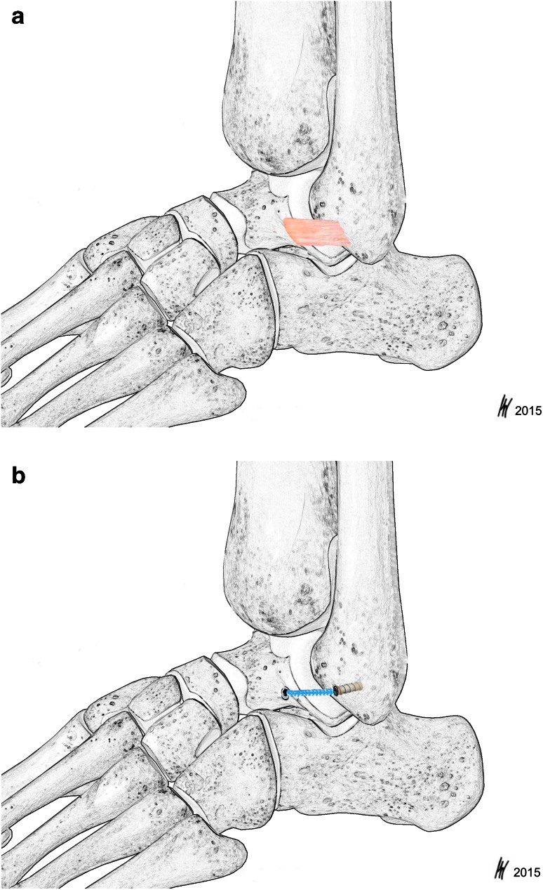 Fig. 3