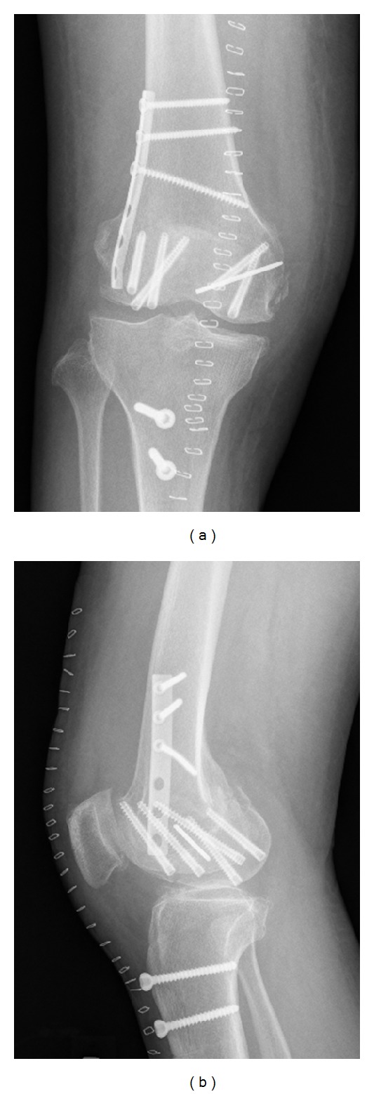 Figure 4