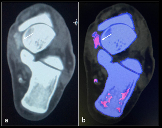 Fig. 5